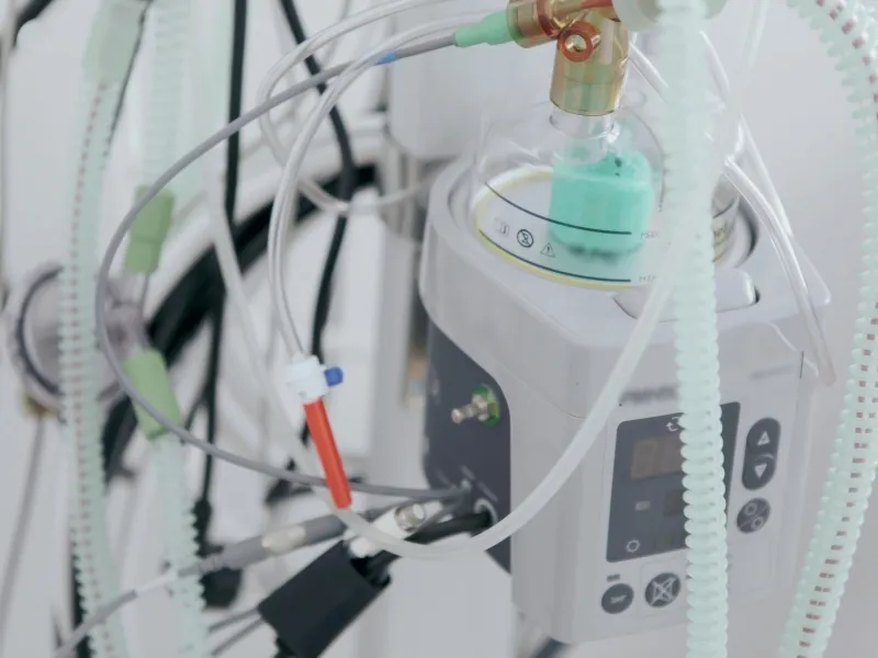 Ventilador Mecánico