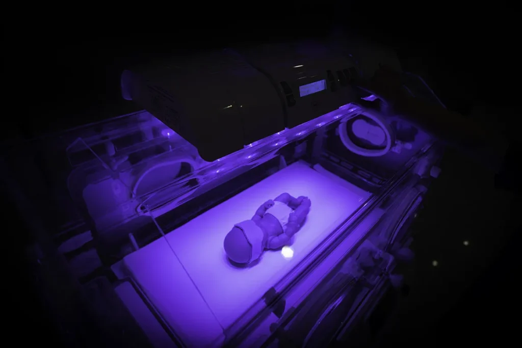 Unidad de Fototerapia Avanzada